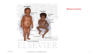 3/21/2019
@Nischal Shrestha
6
 