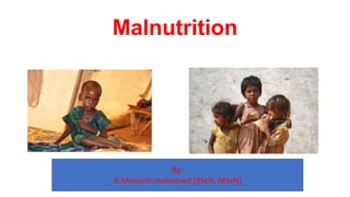 Malnutrition
By:
A.Masooth mohamed (BScN, MScN)
 