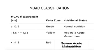 Muac Guidelines Comprehensive Overview of Malnutrition: Definitions, Classifications ...