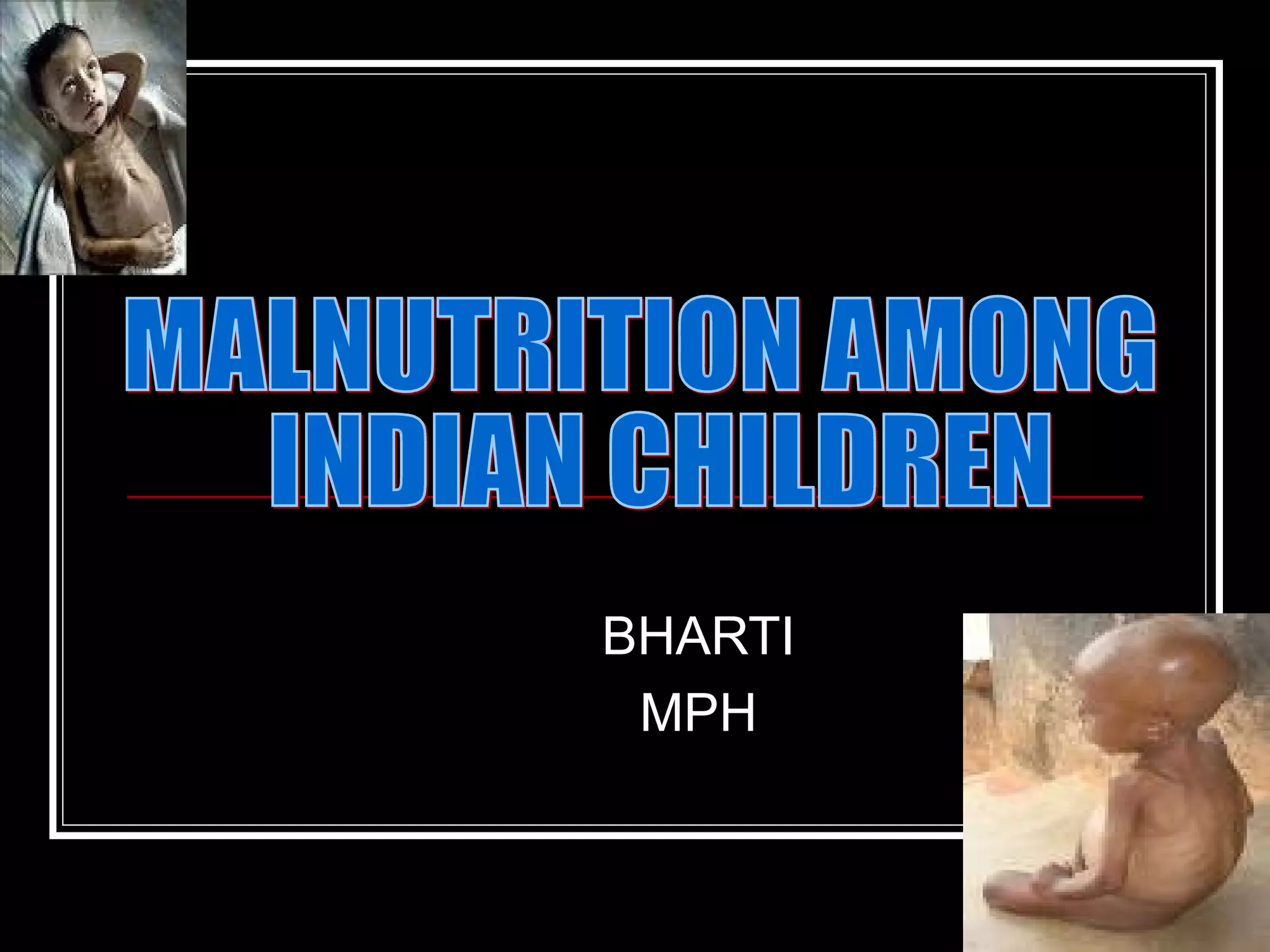 Malnutrition Among Indian Children | PPT