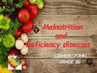 Malnutrition
and
Deficiency diseases
LIDHYA JOHN
GRADE 8G
 