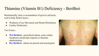 Thiamine (Vitamin B1) Deficiency - BeriBeri
Biochemically, there is accumulation of pyruvic and lactic
acid in body fluids Causes:-.
● Weakness of eye Movement and Mental Disturbance
● Cardiac Disfunction
Two Forms:-
● Wet Beriberi:- generalized edema, acute cardiac
Symptoms and prompt response to thiamine
administration
● Dry Beriberi:- edema not present and neurological
 
