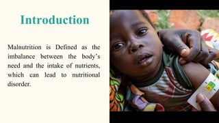 Introduction
Malnutrition is Defined as the
imbalance between the body’s
need and the intake of nutrients,
which can lead to nutritional
disorder.
 