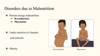 Disorders due to Malnutrition
❖ Protein-energy malnutrition
➢ Kwashiorkor
➢ Marasmus
❖ Under nutrition of vitamins
and minerals
❖ Obesity Kwashiorkor Marasmus
 
