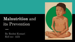 Malnutrition and
its Prevention
By Roshni Kumari
Roll no:- A25
 