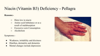 Niacin (Vitamin B3) Deficiency - Pellagra
Reasons:-
○ Diets low in niacin
○ Amino acid Imbalance or as a
result of malabso...