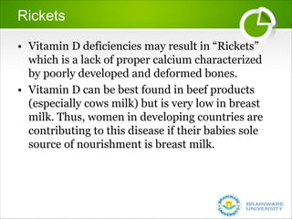 Malnutrition by monal das.pdf