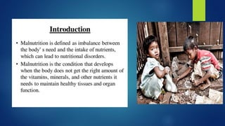 Malnutrition by Sakshi.pdf