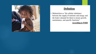 Malnutrition by Sakshi.pdf