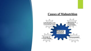 Malnutrition by Sakshi.pdf