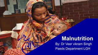 Malnutrition
By: Dr Veer vikram Singh
Paeds Department LGH
 