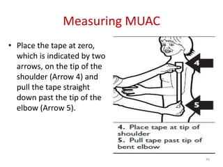 Muac Guidelines Malnutrition harare hosp(3) | PPTX