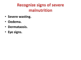 • Severe wasting.
• Oedema.
• Dermataosis.
• Eye signs.
 