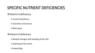 SPECIFIC NUTRIENT DEFICIENCIES
Vitamin A deficiency
corneal cloudiness,
ulceration and xerosis
Bitot spots
Vitamin D deficiency
Skeletal changes with beading of the ribs
widening of the wrists
bowed legs
 