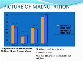 Malnutrition in under five children | PPT