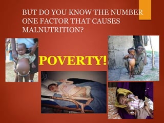 BUT DO YOU KNOW THE NUMBER
ONE FACTOR THAT CAUSES
MALNUTRITION?
POVERTY!
 