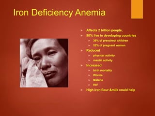 Iron Deficiency Anemia
 Affects 2 billion people,
 90% live in developing countries
 39% of preschool children
 52% of pregnant women
 Reduced
 physical activity
 mental activity
 Increased
 birth mortality
 Worms
 Malaria
 HIV
 High iron flour &milk could help
http://www.micronutrient.org/reports/images/Page16Image.jpg
 