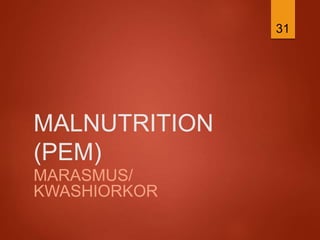 MALNUTRITION
(PEM)
MARASMUS/
KWASHIORKOR
31
 
