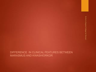 DIFFERENCE IN CLINICAL FEATURES BETWEEN
MARASMUS AND KWASHIORKOR
 