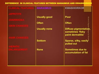 CLINICAL FEATURES
-APPETITE
-DIARRHOEA
-SKIN CHANGES
-HAIR CHANGES
-HEPATIC
ENLARGEMENT
MARASMUS
Usually good
Often
Usually none
Seldom
None
KWASHIORKOR
Poor
Often
Diffuse pigmentation,
sometimes ‘flaky
paint dermatitis’
Sparse, silky, easily
pulled out
Sometimes due to
accumulation of fat
DIFFERENCE IN CLINICAL FEATURES BETWEEN MARASMUS AND KWASHIORKOR
 