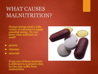 WHAT CAUSES
MALNUTRITION?
Human beings need a wide
variety of nutrients to supply
essential energy. Do you
know what nutrients we
need?
 protein
 vitamins
 minerals
If any one of these nutrients
is deficient in a person's diet,
he/she may suffer from
malnutrition
 