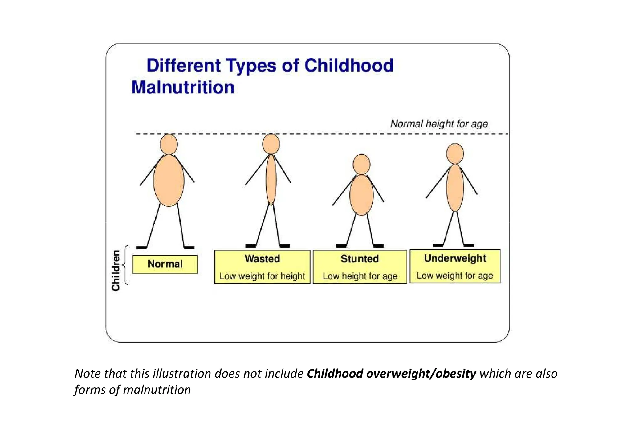 Note that this illustration does not include Childhood overweight/obesity which are also
forms of malnutrition
 