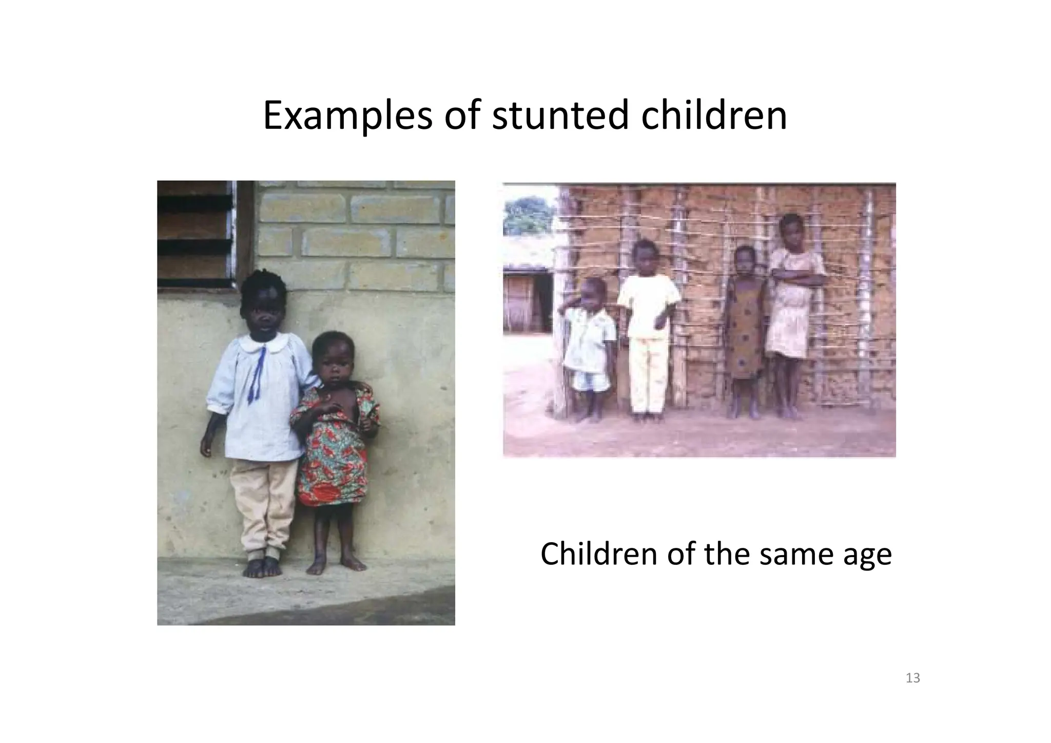 Examples of stunted children
13
Children of the same age
 