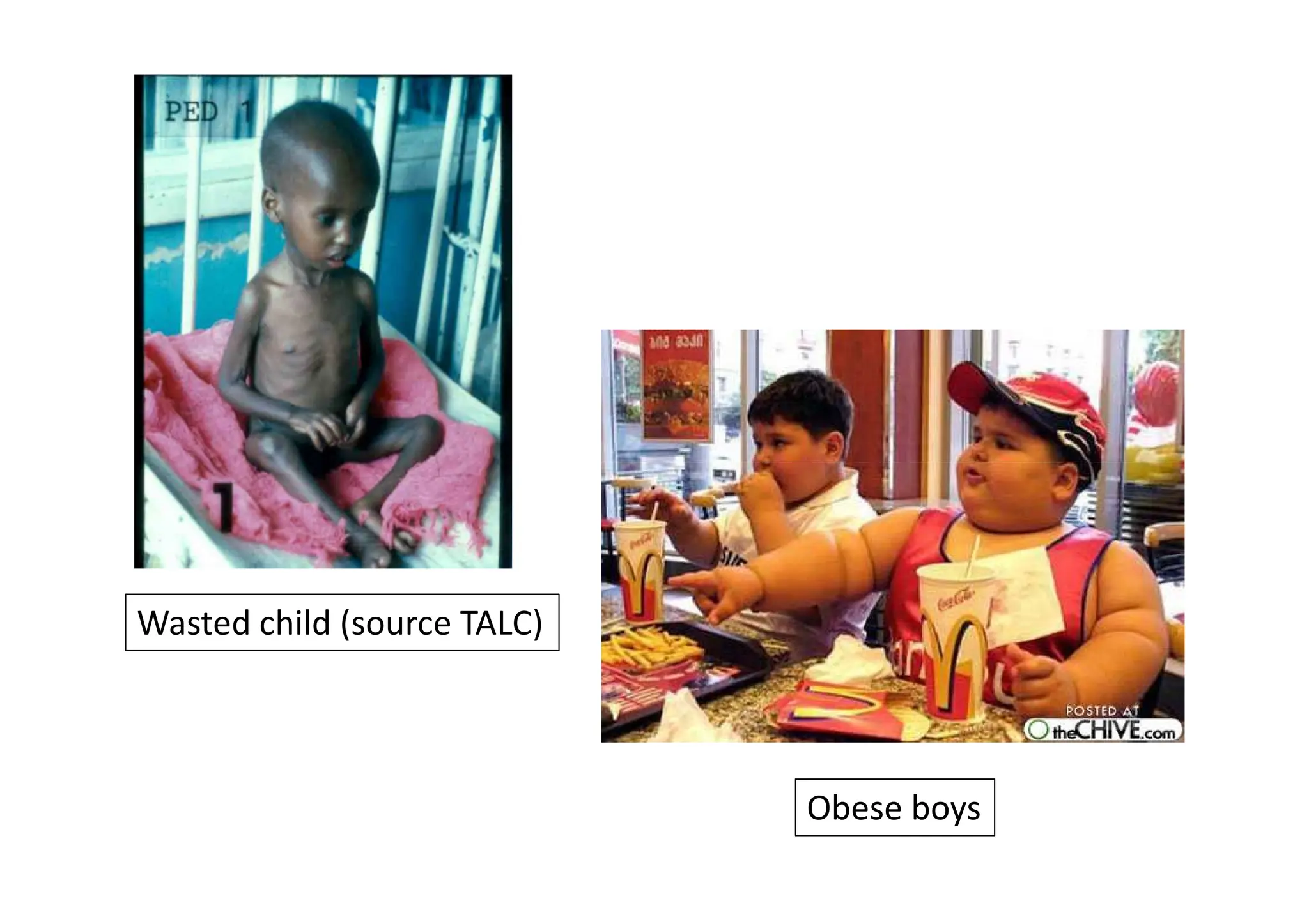 Wasted child (source TALC)
Obese boys
 