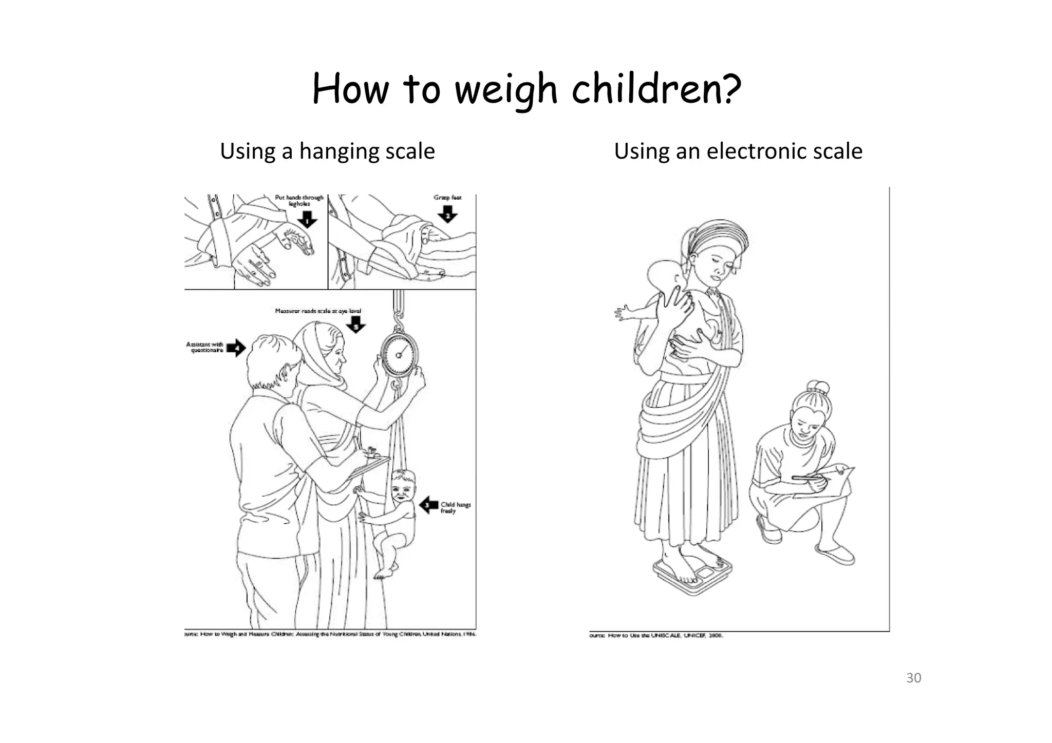 How to weigh children?
Using a hanging scale Using an electronic scale
30
 