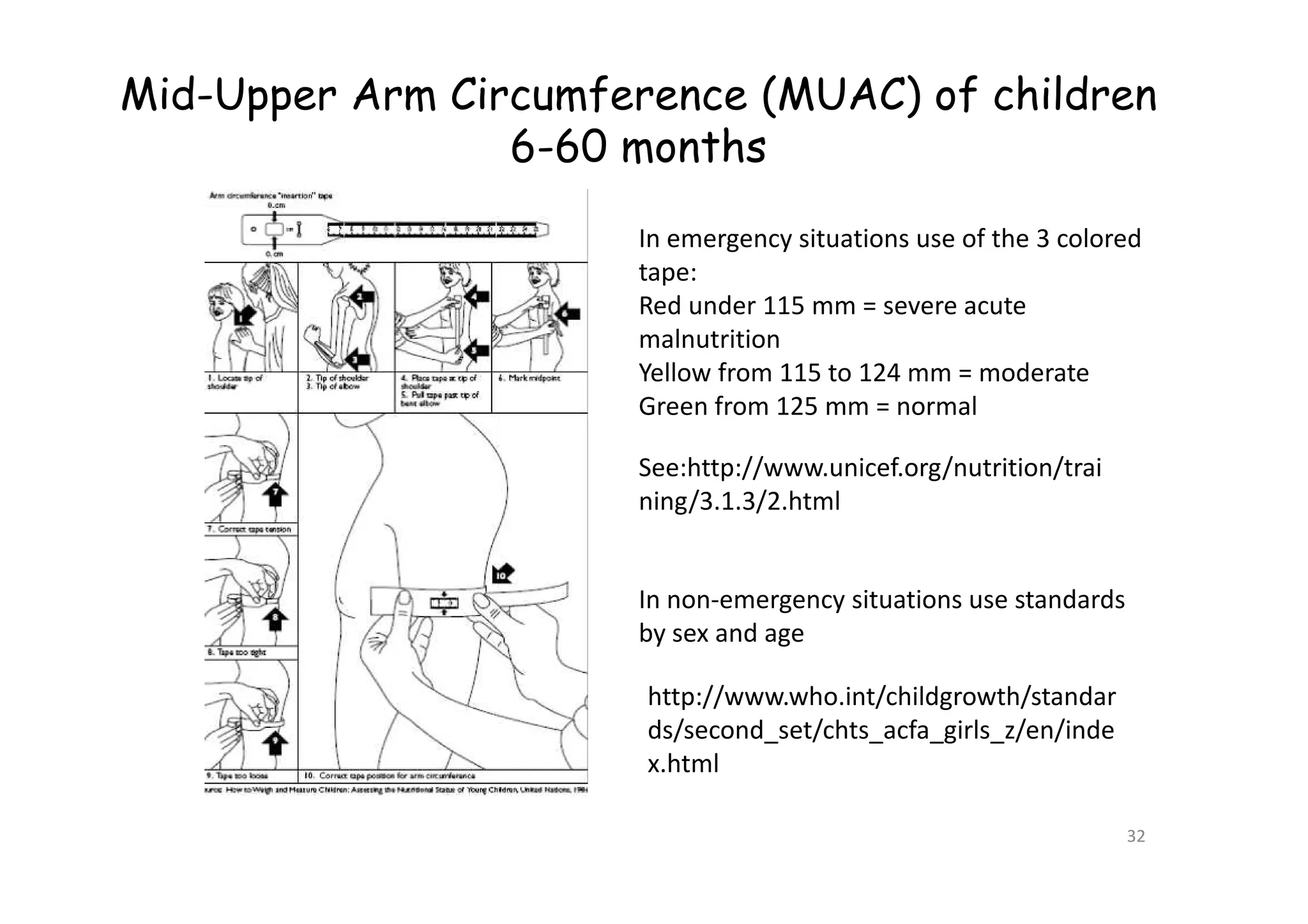 Mid-Upper Arm Circumference (MUAC) of children
6-60 months
See:http://www.unicef.org/nutrition/trai
In emergency situations use of the 3 colored
tape:
Red under 115 mm = severe acute
malnutrition
Yellow from 115 to 124 mm = moderate
Green from 125 mm = normal
32
http://www.who.int/childgrowth/standar
ds/second_set/chts_acfa_girls_z/en/inde
x.html
See:http://www.unicef.org/nutrition/trai
ning/3.1.3/2.html
In non-emergency situations use standards
by sex and age
 
