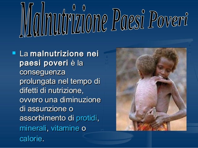 Malnutrizione