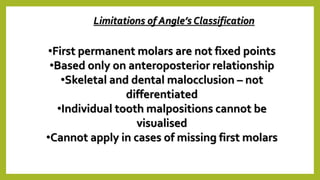Tooth Case Classification Malocclusion of teeth | PPTX