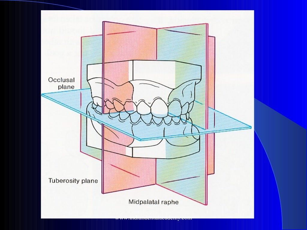 Malocclusion classification /certified fixed orthodontic courses