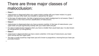 There are three major classes of
malocclusion:
• Class 1
• malocclusion is diagnosed when your upper molars overlap with your lower molars in a good
position, but your other teeth are crowded or spaced too far apart.
• In this type of malocclusion, the bite is typical and your teeth misalignment is not severe. Class 1
malocclusion is the most common classification of malocclusion.
• Class 2
• malocclusion is diagnosed when you have a severe overbite. In this type of malocclusion, your
upper teeth and jaw significantly overlap with your lower teeth and jaw.
• If a class 2 malocclusion happens when you have a smaller than usual lower jaw, it is also known
as retrognathism (or retrognathia).
• Class 3
• malocclusion is diagnosed when you have a severe underbite. In this type of malocclusion, your lower
teeth overlap with your upper teeth.
• This type is usually caused by a large lower jaw and is known as prognathism, meaning that your lower jaw
protrudes forward.
•
 
