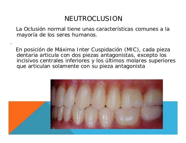 Maloclusion,Tipos y Clasificación