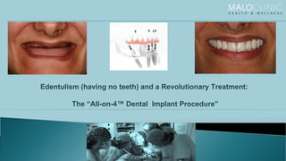 Edentulism (having no teeth) and a Revolutionary Treatment: The “All-on-4™ Dental  Implant Procedure” 