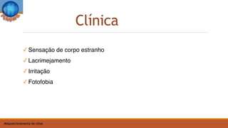 Clínica
Malposicionamento de cílios
✓ Sensação de corpo estranho
✓ Lacrimejamento
✓ Irritação
✓ Fotofobia
 