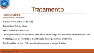Tratamento
Malposicionamento de cílios
Termoablacao com laser
Triquíase menor/maior até 12 cílios
Destruição do folículo piloso
Melhor modalidade terapeutica
Destruição do folículo piloso anormal pelos efeitos da fotocoagulacao e fotovaporizacao com raios laser.
A fotócóagulacao é o resultado da transformação de energia luminosa em térmica
Reação tecidual mínima - Pode ser aplicado em um número maior de cílios
Não Cirúrgico
 