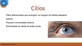 Pêlos diferenciados que emergem na margem do folheto palpebral
anterior
Possuem convexidade externa
Extremidade se afasta do bulbo ocular
Cílios
Malposicionamento de cílios
 