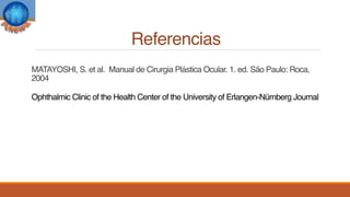 Referencias
MATAYOSHI, S. et al. Manual de Cirurgia Plástica Ocular. 1. ed. São Paulo: Roca,
2004
Ophthalmic Clinic of the Health Center of the University of Erlangen-Nürnberg Journal
 