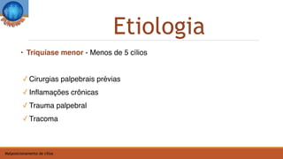• Triquíase menor - Menos de 5 cílios
✓ Cirurgias palpebrais prévias
✓ Inflamações crônicas
✓ Trauma palpebral
✓ Tracoma
Etiologia
Malposicionamento de cílios
 