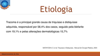 Tracoma é a principal grande causa de triquíase e distiquíase
adquirida, responsável por 58,4% dos casos, seguido pela blefarite
com 19,1% e pelas alterações dermatológicas 15,7%
Etiologia
MATAYOSHI, S. et al. Triquíase e Distiquíase, Manual de Cirurgia Plástica, 2004
Malposicionamento de cílios
 