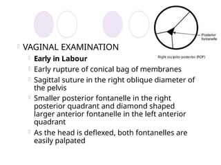 Comprehensive Overview of Fetal Malposition and Presentation in Labor ...