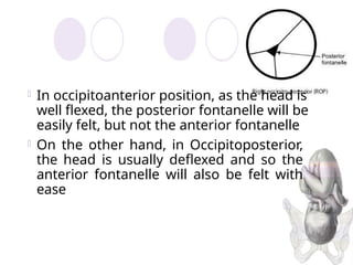 Comprehensive Overview of Fetal Malposition and Presentation in Labor ...