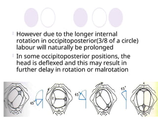 Comprehensive Overview of Fetal Malposition and Presentation in Labor ...