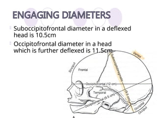 Comprehensive Overview of Fetal Malposition and Presentation in Labor ...