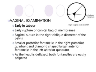 Deflexed malpositionandmalpresentations-160108183858.pdf