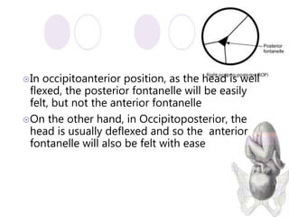Deflexed Malposition and malpresentations | PPTX
