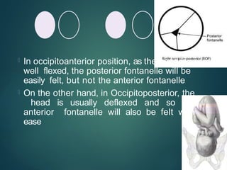  In occipitoanterior position, as the head is
well flexed, the posterior fontanelle will be
easily felt, but not the anterior fontanelle
 On the other hand, in Occipitoposterior, the
head is usually deflexed and so the
anterior fontanelle will also be felt with
ease
 