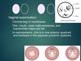  Vaginal examination
 Conrical bag of membranes
 Chin, mouth, nose, mala eminences, and
supraorbital ridges are felt
 In mentoanterior, chin is in one anterior quadrant
and forehead in the opposite posterior quadrant
 